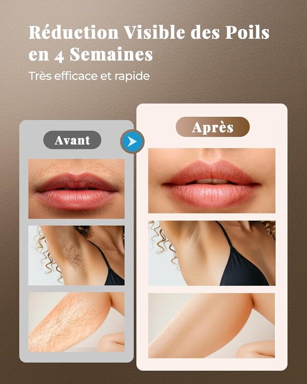 Épilateur Lumière Pulsée, 9 Niveaux d'énergie IPL Épilateur Laser Définitif, 3 en 1 [HR/SC/RA] Épilation Laser Hair Removal Indolore pour Visage/Aisselles/Bikini,Femme,Homme