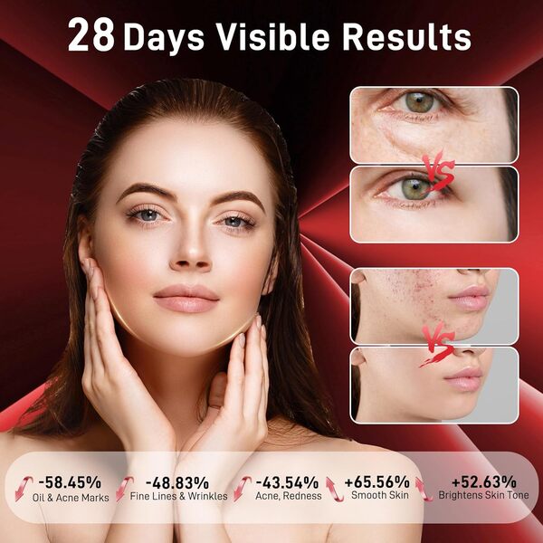 Masque facial LED – 3 modes de lumière, confort ultra doux, longueur d'onde précise, masque professionnel de thérapie par lumière rouge, masque de thérapie par lumière LED pour le
