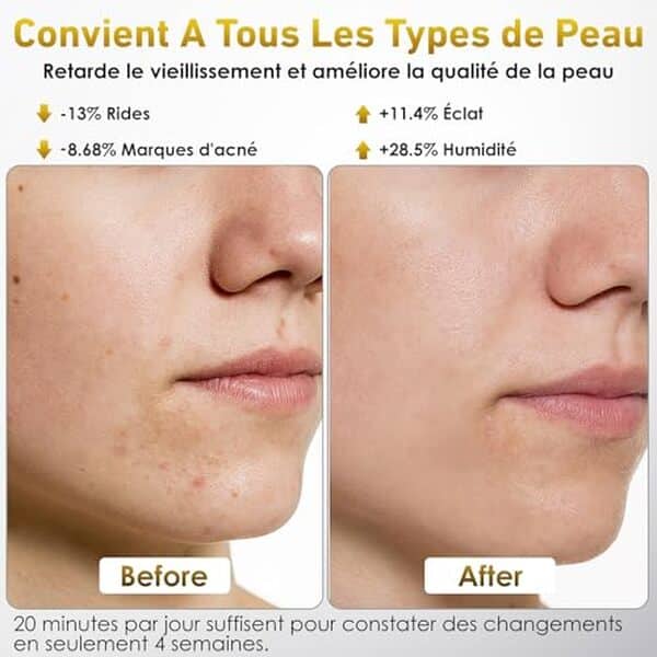 Découvrez notre test complet du masque LED visage Ntyikul 7 couleurs. Efficacité anti-âge, mode d'emploi et résultats : tout ce qu'il faut savoir avant d'acheter. 